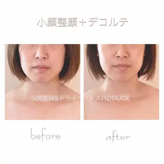 小顔＆美肌 Re :setのエステ・リラクイメージ