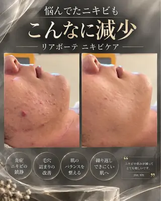 BLOSSOM 菊地のその他イメージ