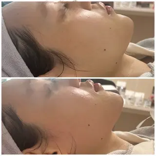 オンダリフト・美肌 Red しずるのエステ・リラクイメージ