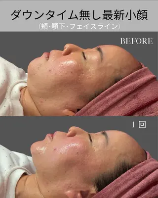 オンダリフト小顔・ ワックス脱毛×光脱毛のエステ・リラクイメージ