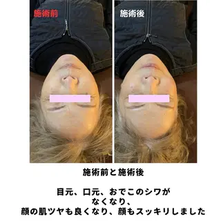瀬口 樹のエステ・リラクイメージ