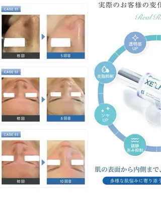 mariange 〜美肌・美容脱毛〜のエステ・リラクイメージ