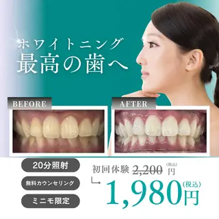 サロン ベレッツァ セルフホワイトニングのエステ・リラクイメージ