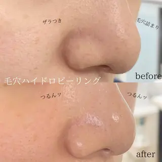 メンズ 稲嶺 美華のエステ・リラクイメージ