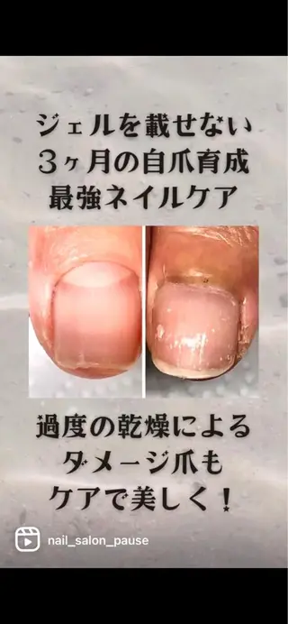 ネイル 自爪育成ネイルサロン Pause(ポーズ)のネイルデザイン