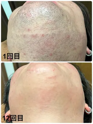 メンズ Mens Salon SOLEのエステ・リラクイメージ