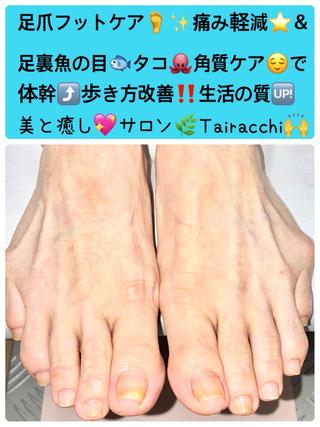 ネイル Tairacchi タイラッチのネイルデザイン