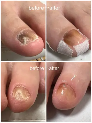 ネイル Belulu ベルルのネイルデザイン