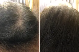 ヘアアレンジ セントラル鍼灸院 Re:laxyのヘアスタイル