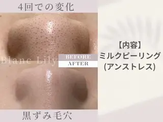ピーリング専門サロン サロンブランリリーのエステ・リラクイメージ