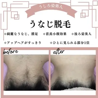 🌷MURA 毛穴・顔脱毛🌷のエステ・リラクイメージ