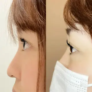 マツエク・マツパ 冨永 梓TiaLashのマツエク・マツパデザイン