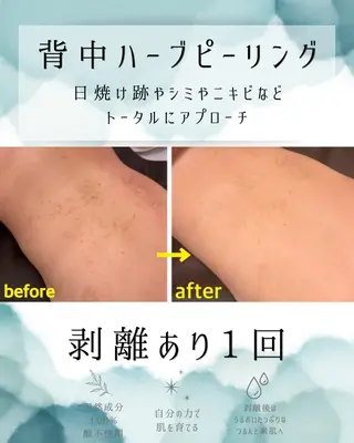 医療提携 肌管理痩身エステ池袋のエステ・リラクイメージ
