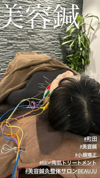 小顔矯/美容鍼/鍼灸 BeauJuのその他イメージ