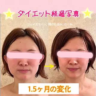 ショート カラー パーマ ヘアアレンジ メンズ キッズ ネイル マツエク・マツパ 痩身&ボディ 結果出し🌟丹野のエステ・リラクイメージ