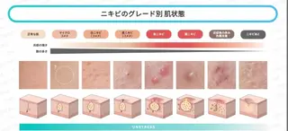 美肌脱毛/骨盤ケア /肩こり/慢性疲労のエステ・リラクイメージ