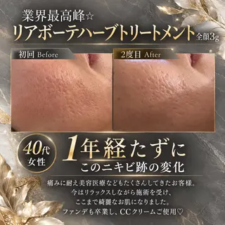 BLOSSOM 菊地のその他イメージ