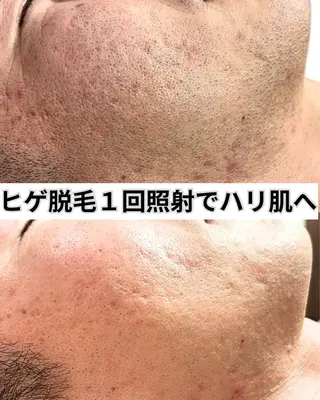 脱毛サロン FIS武蔵小杉店のエステ・リラクイメージ