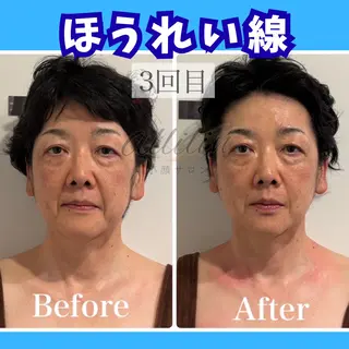 💎小顔ｻﾛﾝ アリリン銀座💎のエステ・リラクイメージ