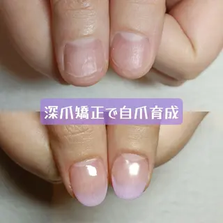 ネイル 深爪矯正/爪育成ケア manie nailのネイルデザイン