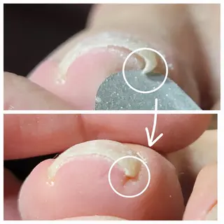 ネイル&巻き爪サロン AKnailのネイルデザイン