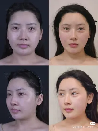 愛維美水光専門店 川崎彩鳳のエステ・リラクイメージ