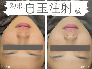エステ&ヘアー ALPHA PLUSのエステ・リラクイメージ