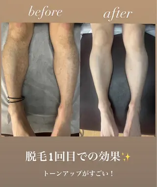 メンズ キッズ 脱毛🌈Beauty Salon新宿店のエステ・リラクイメージ