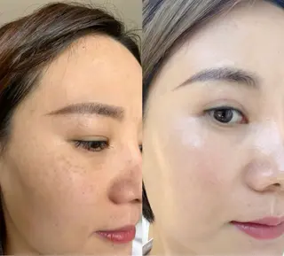 ネイル 愛維美水光専門店 川崎彩鳳のエステ・リラクイメージ