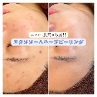 SOLEILnail &beautyのエステ・リラクイメージ