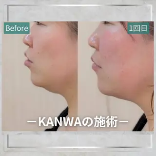 KANWA 鍼灸院のエステ・リラクイメージ