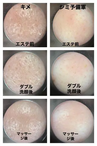 丸の内ヒルズ 今井琴恵のエステ・リラクイメージ
