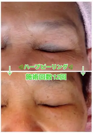 脱毛&美容サロン Dr.Epiのエステ・リラクイメージ