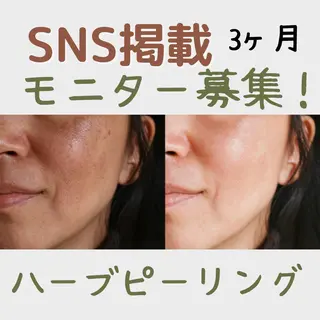 切らない脂肪吸引🔥 Neroliまりこのエステ・リラクイメージ