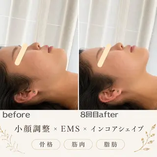 最速小顔・肌管理 espoir 阿部のエステ・リラクイメージ