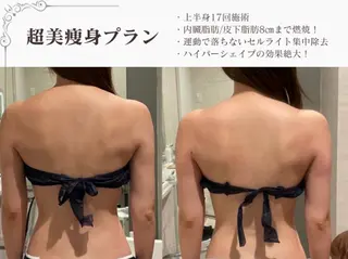 総合美容サロン LOVEME渋谷本店のエステ・リラクイメージ