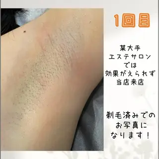 脱毛&リラク FIS福岡薬院店のエステ・リラクイメージ