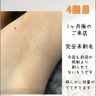 脱毛&リラク FIS福岡薬院店のエステ・リラクイメージ