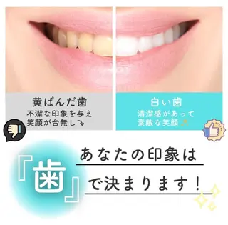 セルフホワイトニング エクシア大宮東口店のその他イメージ