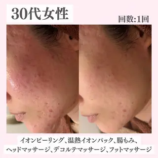 ニキビ・肌質改善専門 ♡人生が変わるサロンのエステ・リラクイメージ