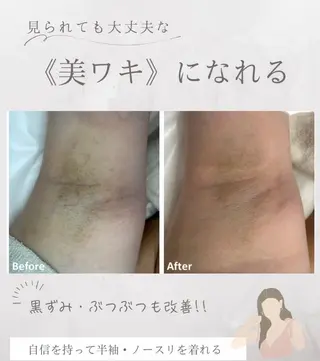 RILsalon 脱毛/フェイシャルのエステ・リラクイメージ
