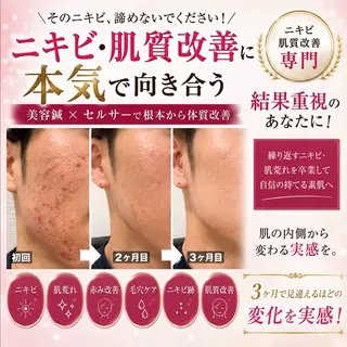 メンズ 大阪上本町 肌質改善×美容鍼ゆいのエステ・リラクイメージ