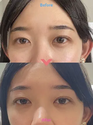 アイブロウ 🎀Luana🎀 トータルビューティーのエステ・リラクイメージ