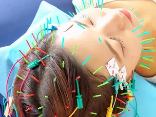 渋谷 小顔美容鍼 専門サロン YZのエステ・リラクイメージ