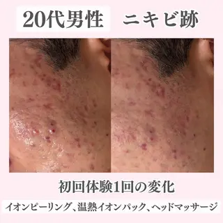 ニキビ・肌質改善専門 ♡人生が変わるサロンのエステ・リラクイメージ