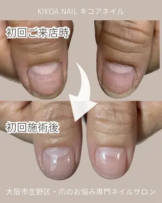 ネイル KIKOA NAIL キコアネイルのネイルデザイン