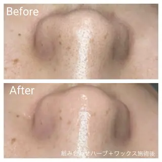 深い肌悩み&早期脱毛 完了サロンのエステ・リラクイメージ