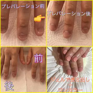 ネイル ♢ME2ROOM♢ #巻き爪#リラクのネイルデザイン