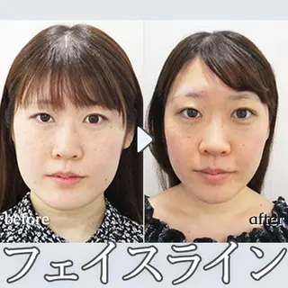 銀座美.design 難波店のエステ・リラクイメージ