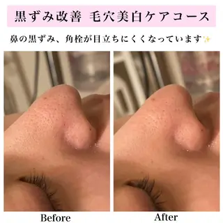 Bellesthe (ベルエステ)のエステ・リラクイメージ